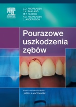 Pourazowe uszkodzenia zębów 2 wydanie